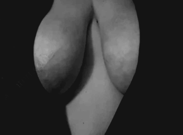 Andrea
